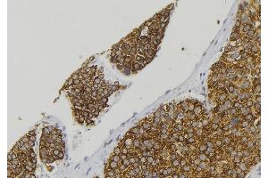 ABIN6278430 at 1/100 staining Human pancreas tissue by IHC-P. (CGRP 抗体  (Internal Region))