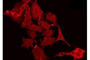 ABIN6266890 staining HT29 by IF/ICC. (MLK4 抗体)
