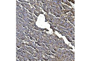 IHC analysis of EGFR using anti-EGFR antibody (ABIN7600915).