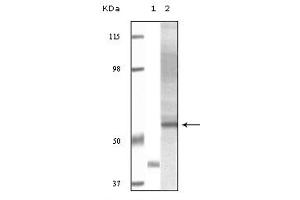 Western Blotting (WB) image for anti-V-Akt Murine Thymoma Viral Oncogene Homolog 3 (Protein Kinase B, Gamma) (AKT3) (truncated) antibody (ABIN2464009)
