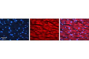 Immunohistochemistry (IHC) image for anti-Lymphocyte-Specific Protein 1 (LSP1) (N-Term) antibody (ABIN2792094)