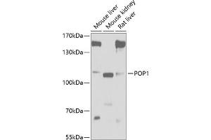 Western blot analysis of extracts of various cell lines, using POP1 antibody (ABIN6133335, ABIN6145961, ABIN6145962 and ABIN6221643) at 1:1000 dilution. (POP1 抗体  (AA 1-210))