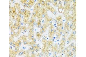 Immunohistochemistry of paraffin-embedded Human liver using ASGR1 Polyclonal Antibody at dilution of 1:100 (40x lens). (Asialoglycoprotein Receptor 1 抗体)