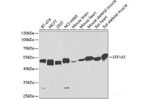 Western blot analysis of extracts of various cell lines using EEF1A2 Polyclonal Antibody at dilution of 1:1000. (EEF1A2 抗体)