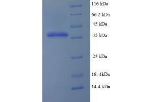 SDS-PAGE (SDS) image for Dihydrofolate Reductase (DHFR) (AA 2-187) protein (His-SUMO Tag) (ABIN5709401) (Dihydrofolate Reductase Protein (DHFR) (AA 2-187) (His-SUMO Tag))
