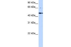 WB Suggested Anti-LYK5 Antibody Titration:  0. (STRADA 抗体  (C-Term))