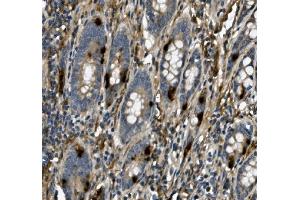 IHC analysis of USP44 using anti-USP44 antibody (ABIN7600640). (USP44 抗体  (AA 211-712))