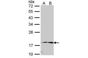 Image no. 1 for anti-Peptidylprolyl Cis/trans Isomerase, NIMA-Interacting 1 (PIN1) (AA 1-133) antibody (ABIN467591) (PIN1 抗体  (AA 1-133))