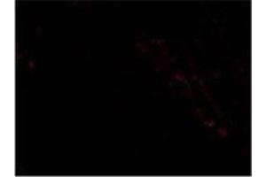 AP20061PU-N PIST antibody staining of PIST in Rat Colon cells by Immunofluorescence. (GOPC 抗体  (Middle Region))
