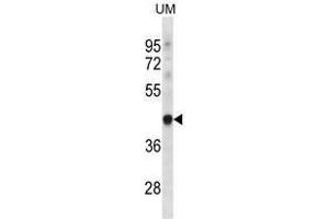 Western Blotting (WB) image for anti-TruB Pseudouridine (Psi) Synthase Homolog 1 (TRUB1) (AA 159-188), (Middle Region) antibody (ABIN955345)
