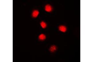 Immunofluorescent analysis of Cyclin E1 staining in MCF7 cells. (Cyclin E1 抗体  (C-Term))