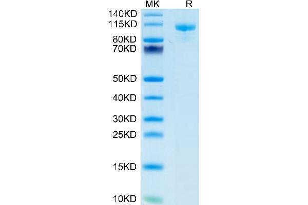 LRP5 Protein (AA 644-1263) (mFc Tag)