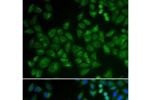 Immunofluorescence analysis of HeLa cells using SMPD1 / ASM Polyclonal Antibody (SMPD1 抗体)