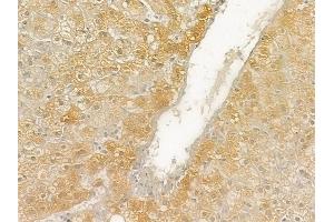 ABIN6261772 and ABIN6276946 at 1/100 staining human normal liver tissue by IHC-P.