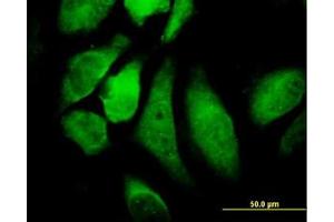 Image no. 2 for anti-conserved Helix-Loop-Helix Ubiquitous Kinase (CHUK) (AA 646-745) antibody (ABIN598612) (IKK alpha 抗体  (AA 646-745))