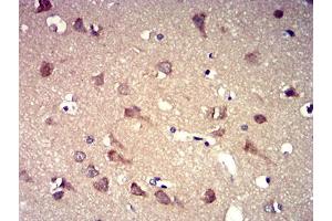 Immunohistochemical analysis of paraffin-embedded brain tissues using P2RY8 mouse mAb with DAB staining. (P2RY8 抗体)