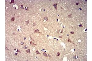 Immunohistochemical analysis of paraffin-embedded brain tissues using P2RY8 mouse mAb with DAB staining.