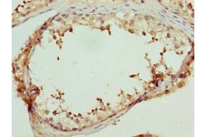 Immunohistochemistry of paraffin-embedded human testis tissue using ABIN7158142 at dilution of 1:100 (LRRC18 抗体  (AA 1-261))