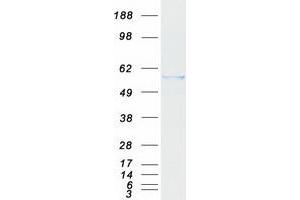 Western Blotting (WB) image for Aldehyde Dehydrogenase 1 Family, Member A2 (ALDH1A2) (Transcript Variant 2) protein (Myc-DYKDDDDK Tag) (ABIN2714538)