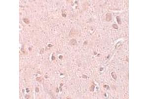 Immunohistochemistry (IHC) image for anti-NSA2 Ribosome Biogenesis Homolog (NSA2) (C-Term) antibody (ABIN1030737) (NSA2 抗体  (C-Term))