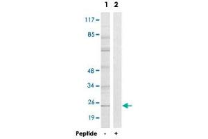 Western blot analysis of extracts from HT-29 cells, using GJB7 polyclonal antibody . (GJB7 抗体)