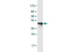 Western Blot detection against Immunogen (36. (KIF13B 抗体  (AA 1-100))