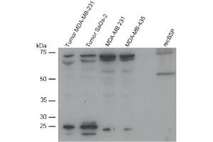 Western Blot analysis of BSP expression in different cell lines. (BSP 抗体  (AA 201-211))