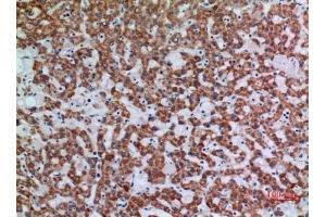 Immunohistochemical analysis of paraffin-embedded human-liver, antibody was diluted at 1:100. (APAF1 抗体  (Internal Region))