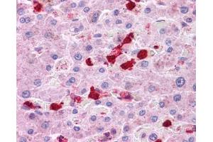 LRRC8B antibody was used for immunohistochemistry at a concentration of 4-8 ug/ml.