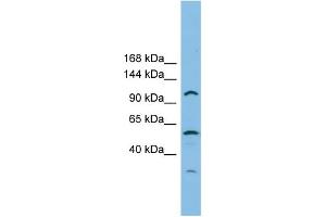 WB Suggested Anti-CHTF18 Antibody Titration: 0. (CTF18 抗体  (Middle Region))