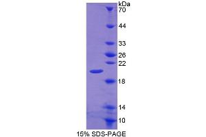 SDS-PAGE analysis of Rat CALY Protein. (CALY 蛋白)