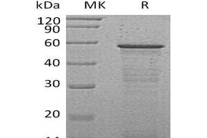 Western Blotting (WB) image for Host Cell Factor C2 (HCFC2) protein (His tag) (ABIN7320755) (HCFC2 Protein (His tag))