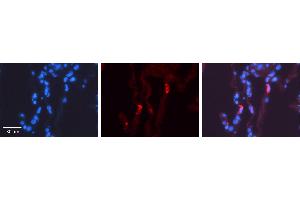 LMAN2 antibody - N-terminal region          Formalin Fixed Paraffin Embedded Tissue:  Human Lung Tissue    Observed Staining:  Cytoplasm of pneumocytes   Primary Antibody Concentration:  1:100    Other Working Concentrations:  1/600    Secondary Antibody:  Donkey anti-Rabbit-Cy3    Secondary Antibody Concentration:  1:200    Magnification:  20X    Exposure Time:  0. (LMAN2 抗体  (N-Term))