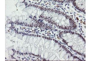 Immunohistochemical staining of paraffin-embedded Human colon tissue using anti-ZBED1 mouse monoclonal antibody. (ZBED1 抗体)