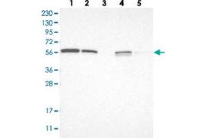 Western blot analysis of Lane 1: RT-4, Lane 2: U-251 MG, Lane 3: Human Plasma, Lane 4: Liver, Lane 5: Tonsil with LETM2 polyclonal antibody  at 1:250-1:500 dilution. (LETM2 抗体)