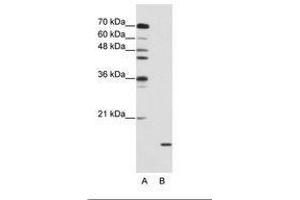 Image no. 2 for anti-Small Nuclear Ribonucleoprotein Polypeptide A (SNRPA) (AA 176-225) antibody (ABIN203017) (SNRPA1 抗体  (AA 176-225))