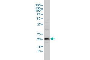 C20orf102 monoclonal antibody (M01), clone 3B9 Western Blot analysis of C20orf102 expression in IMR-32 . (VSTM2L 抗体  (AA 25-204))