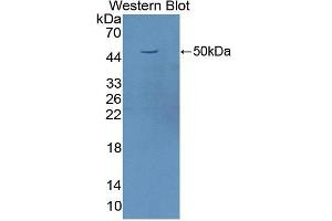 Detection of Recombinant FASL, Human using Polyclonal Antibody to Factor Related Apoptosis Ligand (FASL) (FASL 抗体  (AA 103-281))
