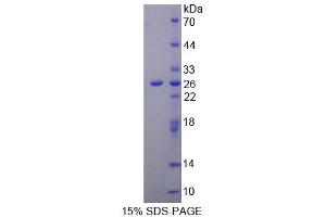 SDS-PAGE analysis of Rat NIN Protein. (Ninein 蛋白)