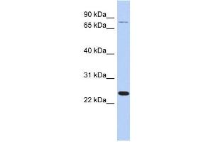 RPS7 antibody used at 1 ug/ml to detect target protein. (RPS7 抗体  (Middle Region))