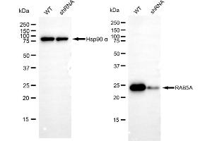 Western blotting analysis using RAB5A antibody (ABIN7800098).