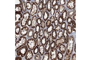 Immunohistochemical staining of human kidney with SPDYC polyclonal antibody  shows strong cytoplasmic positivity in tubular cells at 1:50-1:200 dilution. (SPDYC 抗体)