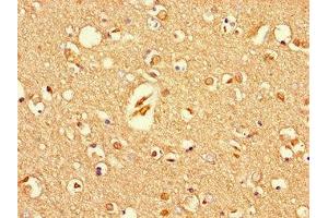 Immunohistochemistry of paraffin-embedded human brain tissue using ABIN7166261 at dilution of 1:100 (Unc-79 Homolog (C. Elegans) (UNC79) (AA 1562-1678) 抗体)