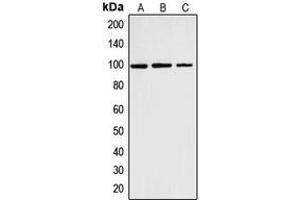 Western blot analysis of Cyclin M2 expression in K562 (A), HT1080 (B), Hela (C) whole cell lysates. (Cyclin M2 抗体  (Center))