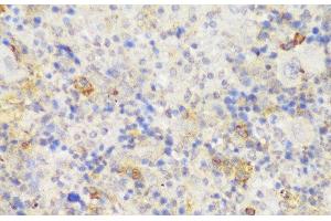 Immunohistochemistry of paraffin-embedded Mouse spleen using GCC2 Polyclonal Antibody at dilution of 1:150 (40x lens). (GCC2 抗体)