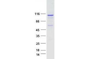 Western Blotting (WB) image for Dual serine/threonine and tyrosine Protein Kinase (DSTYK) (Transcript Variant 1) protein (Myc-DYKDDDDK Tag) (ABIN2730960)