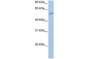 WB Suggested Anti-RIOK3  Antibody Titration: 0. (RIOK3 抗体  (C-Term))