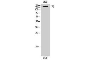 Western Blotting (WB) image for anti-Filaggrin (FLG) (Ser378) antibody (ABIN3184631) (Filaggrin 抗体  (Ser378))