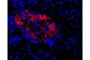Immunohistochemistry (IHC) image for anti-Glutamate Receptor, Ionotropic, N-Methyl D-Aspartate 2c (GRIN2C) (AA 365-377), (Extracellular) antibody (ABIN7043244)