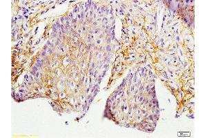 Formalin-fixed and paraffin embedded rat skin labeled with Anti-MIF Polyclonal Antibody, Unconjugated  at 1:200 followed by conjugation to the secondary antibody and DAB staining. (MIF 抗体  (AA 51-115))
